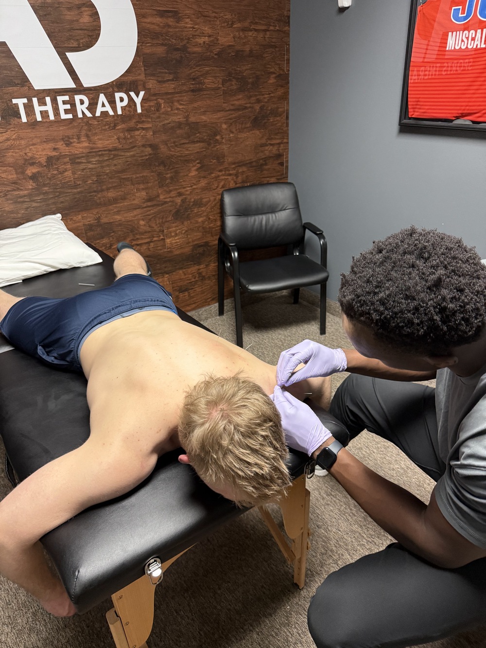 Dry Needling St Paul